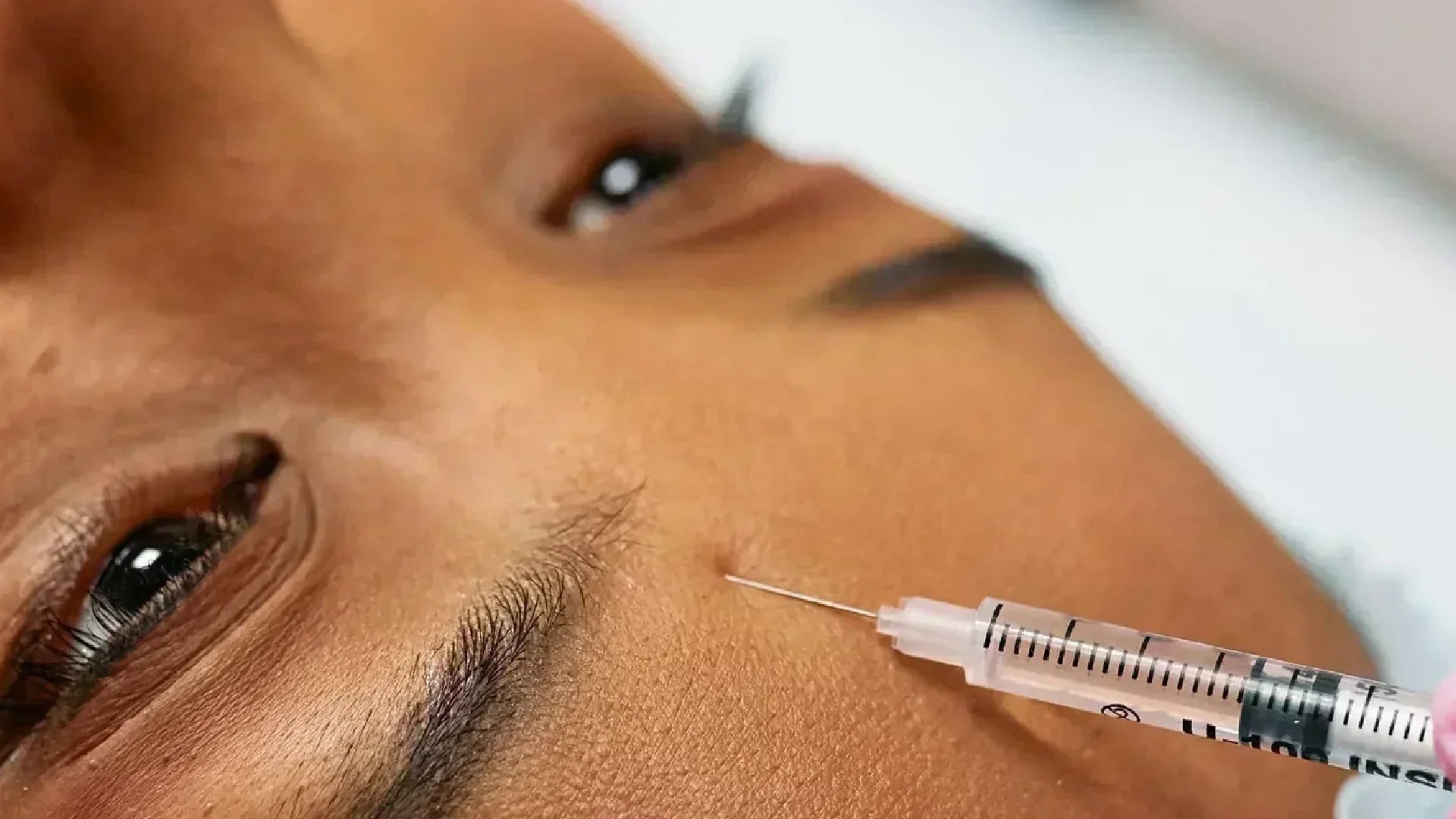 Botox no es suficiente: cómo potenciar tus resultados desde adentro