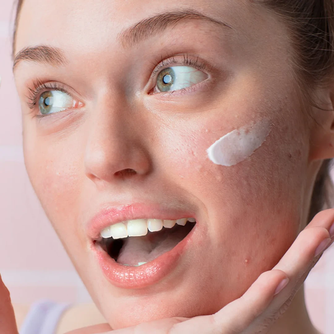 Sebiaclear Hydra Cream